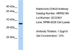 Western Blotting (WB) image for anti-Cyclin-Dependent Kinase 20 (CDK20) (Middle Region) antibody (ABIN2789045) (CCRK antibody  (Middle Region))