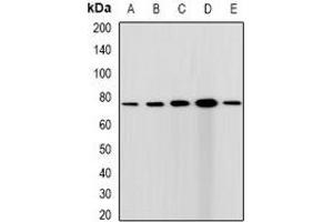 Western blot analysis of CGBP expression in HepG2 (A), Hela (B), A431 (C), mouse spleen (D), rat testis (E) whole cell lysates. (CXXC1 antibody)