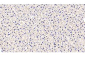 Detection of CAT in Mouse Liver Tissue using Polyclonal Antibody to Catalase (CAT) (Catalase antibody  (AA 80-239))