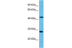 Host:  Mouse  Target Name:  PYGO2  Sample Tissue:  Mouse Pancreas  Antibody Dilution:  1ug/ml (PYGO2 antibody  (N-Term))