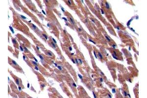 IHC-P analysis of Rat Cardiac Muscle Tissue, with DAB staining. (BACE2 antibody  (AA 242-502))
