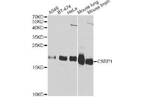 Western blot analysis of extracts of various cell lines, using CSRP1 Antibody. (CSRP1 antibody)