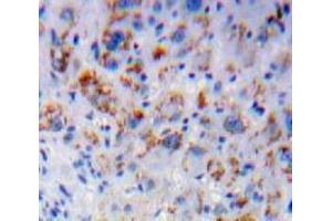 Used in DAB staining on fromalin fixed paraffin-embedded Liver tissue (IL7R antibody  (AA 48-217))