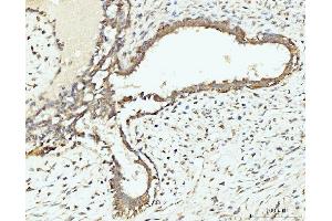 IHC analysis of RPL29 using anti-RPL29 antibody (ABIN7600993). (RPL29 antibody  (AA 27-153))