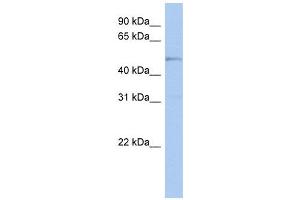 TBC1D10C antibody used at 1 ug/ml to detect target protein.