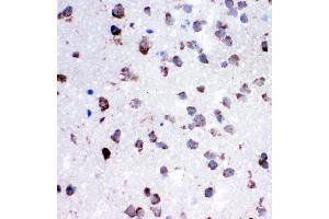 Anti-Cytochrome C antibody, IHC(P) IHC(P): Rat Lung Tissue (Cytochrome C antibody  (C-Term))