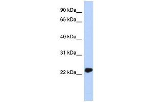 UCHL3 antibody used at 1 ug/ml to detect target protein. (UCHL3 antibody)