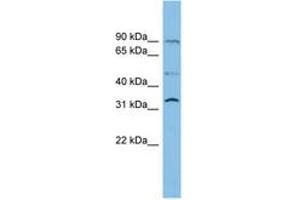 SLC27A3 Antikörper  (AA 503-552)