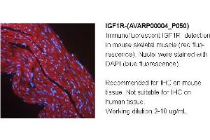 Image no. 1 for anti-Insulin-Like Growth Factor 1 Receptor (IGF1R) (Middle Region) antibody (ABIN504556) (IGF1R antibody  (Middle Region))