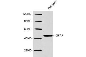 Western blot analysis of lysates using Rabbit Anti-GFAP Polyclonal Antibody (ABIN398827, 1 µg/mL) The signal was developed with IRDye-800 Conjugated Goat Anti-Rabbit IgG. (GFAP antibody  (AA 250-300))
