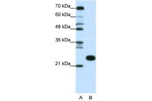 RPL13 antibody used at 0. (RPL13 antibody  (C-Term))
