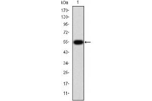 Western blot analysis of TGF β Receptor I expression in HepG2 cells (TGFBR1 antibody  (Internal Region))