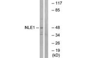Western blot analysis of extracts from COS cells, using NLE1 Antibody.
