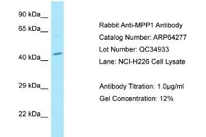 Western Blotting (WB) image for anti-Membrane Protein, Palmitoylated 1, 55kDa (MPP1) (N-Term) antibody (ABIN2789786) (MPP1 antibody  (N-Term))