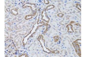 Immunohistochemistry of paraffin-embedded rat kidney using ITGAV antibody. (CD51 antibody  (C-Term))