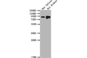 Western Blot Positive WB detected in: Rat Spleen tissue, Rat Kidney tissue All lanes: Ace2 antibody at 1:2000 Secondary Goat polyclonal to rabbit IgG at 1/50000 dilution Predicted band size: 93 kDa Observed band size: 93 kDa (ACE2 antibody  (AA 105-118))