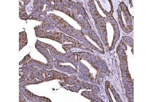 IHC analysis of COX6B1 using anti-COX6B1 antibody (ABIN7603206). (COX6B1 antibody  (N-Term))