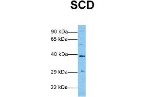 Host:  Rabbit  Target Name:  SCD  Sample Tissue:  Human Jurkat  Antibody Dilution:  1. (SCD antibody  (Middle Region))