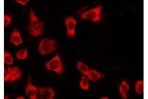 ABIN6278611 staining HeLa by IF/ICC. (OR4Q3 antibody  (C-Term))