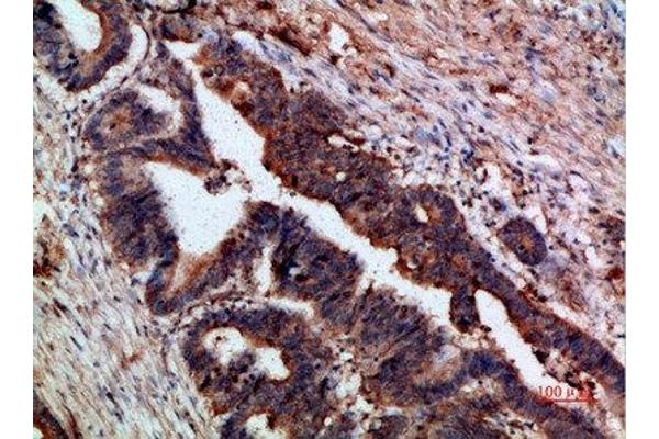 CTNND1 antibody  (AA 841-890)