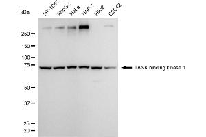 Western blotting analysis using TANK binding kinase 1 antibody (ABIN7800505).