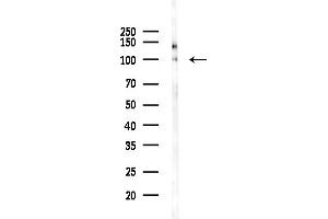 anti-Solute Carrier Family 39 (Zinc Transporter), Member 6 (SLC39A6) (Internal Region) antibody