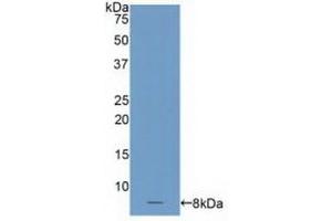 Detection of Recombinant C4BPa, Human using Polyclonal Antibody to C4 Binding Protein Alpha (C4BPa) (C4BPA antibody  (AA 548-597))