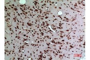 Immunohistochemistry (IHC) analysis of paraffin-embedded Rat Brain, antibody was diluted at 1:100. (Midkine antibody  (Internal Region))