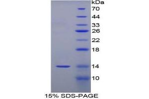 SDS-PAGE analysis of Human Serum Amyloid A Protein.