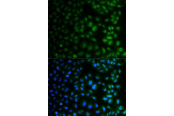 NAA40 antibody