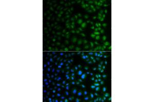 Immunofluorescence analysis of A549 cell using NAA40 antibody. (NAA40 antibody)