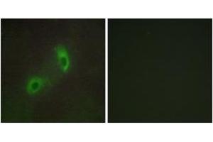 Immunofluorescence analysis of HuvEc cells, using HGS Antibody. (HGS antibody  (AA 451-500))