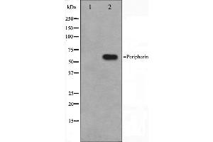 Western blot analysis on HepG2 cell lysate using Peripherin Antibody,The lane on the left is treated with the antigen-specific peptide. (Peripherin antibody  (C-Term))
