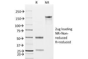 SDS-PAGE (SDS) image for anti-Epithelial Cell Adhesion Molecule (EPCAM) (AA 20-60), (N-Term) antibody (ABIN6939991)