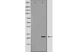 UBE2K antibody  (C-Term)
