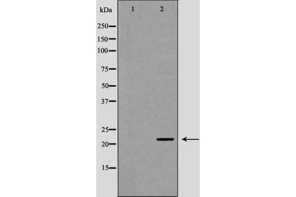 UBE2K antibody  (C-Term)