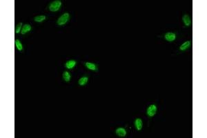 Immunofluorescence staining of Hela with ABIN7127738 at 1:100,counter-stained with DAPI. (Recombinant RAF1 antibody  (pSer43))