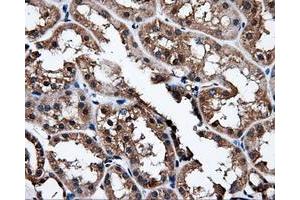 Immunohistochemical staining of paraffin-embedded liver tissue using anti-NPR3mouse monoclonal antibody. (NPR3 antibody)