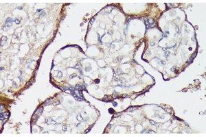 Immunohistochemistry of paraffin-embedded Human placenta using SLC7A2 Polyclonal Antibody at dilution of 1:100 (40x lens).