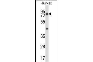 MCOLN1 Antibody (C-term) (ABIN657474 and ABIN2846502) western blot analysis in Jurkat cell line lysates (35 μg/lane). (MCOLN1 antibody  (C-Term))