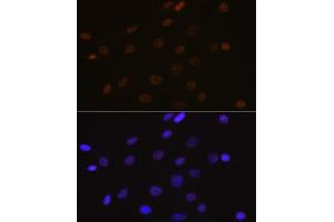 Immunofluorescence analysis of C6 cells using DEK Rabbit mAb (ABIN7266724) at dilution of 1:100 (40x lens). (DEK antibody)