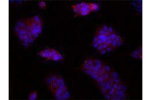 Immunofluorescence (IF) image for anti-Cadherin 1, Type 1, E-Cadherin (Epithelial) (CDH1) antibody (ABIN2664574) (E-cadherin antibody)
