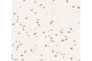 Immunohistochemistry analysis of paraffin-embedded mouse brain using,PRR14 (ABIN7075196) at dilution of 1: 3200 (PRR14 antibody)