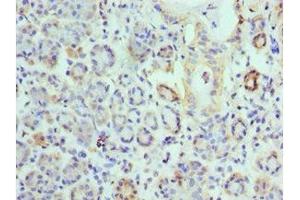 Immunohistochemistry of paraffin-embedded human salivary gland tissue using ABIN7157845 at dilution of 1:100 (EPM2A antibody  (AA 244-331))