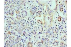 Immunohistochemistry (IHC) image for anti-Epilepsy, Progressive Myoclonus Type 2A, Lafora Disease (Laforin) (EPM2A) (AA 244-331) antibody (ABIN7157845)