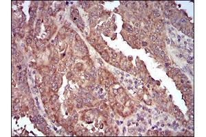 Immunohistochemistry (IHC) image for anti-Caveolin 2 (CAV2) (AA 1-86) antibody (ABIN5542304)