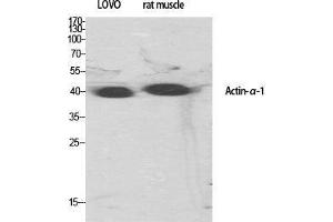 Western Blot (WB) analysis of specific cells using Actin alpha1 Polyclonal Antibody. (Actin antibody  (N-Term))