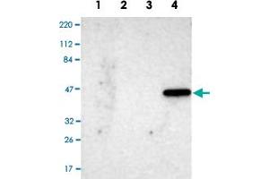 Western Blot analysis of Lane 1: RT-4 cell, Lane 2: U-251 MG sp cell, Lane 3: human plasma tissue (IgG/HSA depleted) and Lane 4: human liver tissue lysates with IL17RB polyclonal antibody . (IL17 Receptor B antibody)
