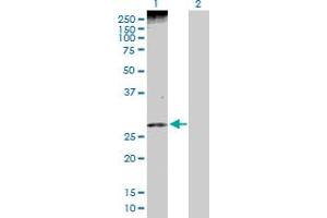 Western Blot analysis of PHLDA1 expression in transfected 293T cell line by PHLDA1 MaxPab polyclonal antibody. (PHLDA1 antibody  (AA 1-259))