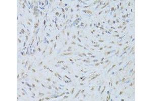 Immunohistochemistry of paraffin-embedded Human endometrium using TARDBP Polyclonal Antibody at dilution of 1:200 (40x lens). (TARDBP antibody)